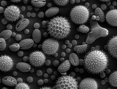 http://galabent.files.wordpress.com/2010/11/pollen-electron-microscope-allergy-causing.jpg
